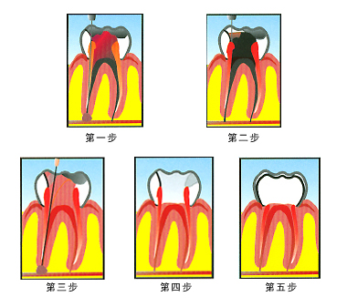 ί,ίE,ί