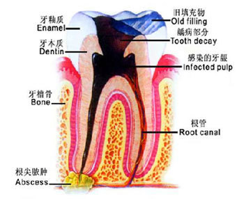 ʲô貿։