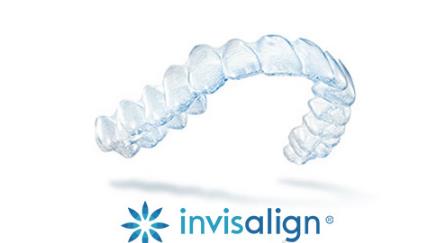 ʲôgInvisalign[mC