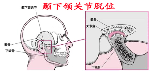 DMP(gun)(ji)