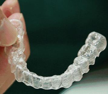 Invisalign[m[XCL(fng)