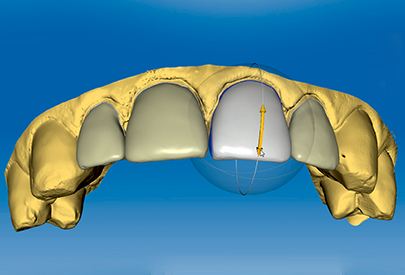 ZCAD/CAM